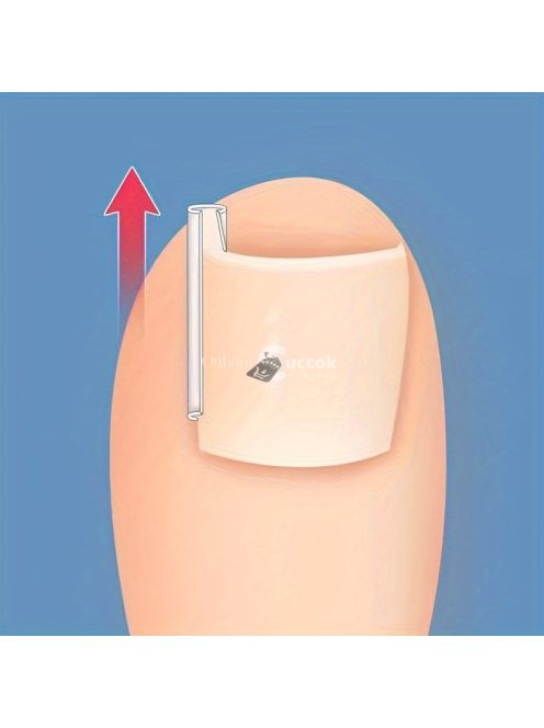 50db Benőtt Köröm Korrekciós Csíkok - Légáteresztő és Rugalmas Pedikűr Eszköz a Fájdalomcsillapításért és Köröm Egészségéért