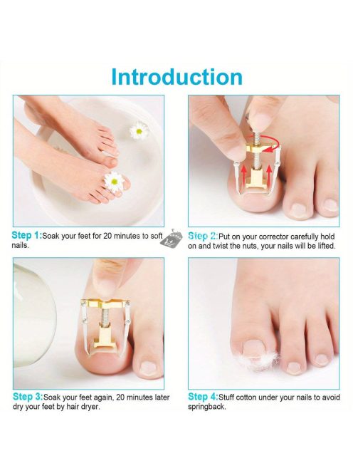 6 darabos körömcsipesz és pedikűr készlet ívelt pengékkel, benőtt körömreszelővel és szögletes vágókkal - Szagmentes manikűr eszközök minden körömtípushoz