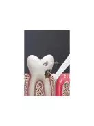 Ulstrasonic fog tisztító