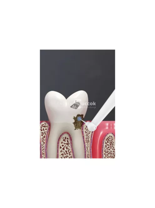 Ulstrasonic fog tisztító