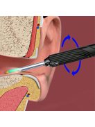 Vezeték nélküli fültisztító eszköz endoszkóp kamerával