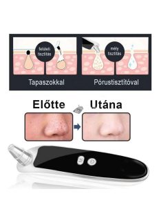 Pórustisztító készülék, Mitesszer Eltávolító