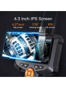 Endoszkóp Ellenőrző Kamera