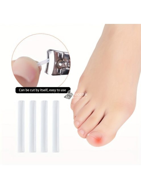 50db Benőtt Köröm Korrekciós Csíkok - Légáteresztő, Rugalmas Pedikűr Eszköz Fájdalomcsillapításra & Köröm Egészségére