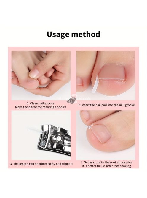 50db Benőtt Köröm Korrekciós Csíkok - Légáteresztő, Rugalmas Pedikűr Eszköz Fájdalomcsillapításra & Köröm Egészségére