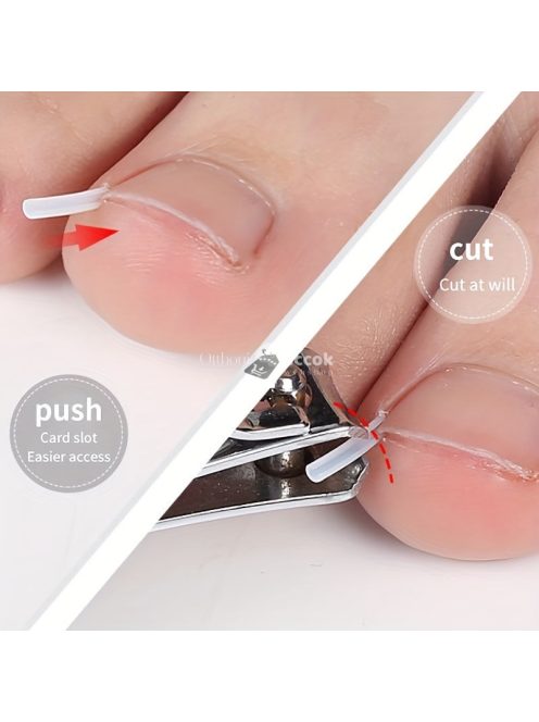 50db Benőtt Köröm Korrekciós Csíkok - Légáteresztő, Rugalmas Pedikűr Eszköz Fájdalomcsillapításra & Köröm Egészségére