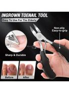 6 darabos körömcsipesz készlet ívelt pengékkel, benőtt körömreszelővel & szögletes vágókkal - Szagmentes manikűr & pedikűr készlet minden körtípushoz