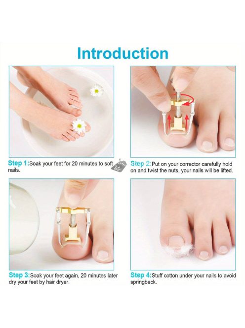 6 darabos körömcsipesz készlet ívelt pengékkel, benőtt körömreszelővel & szögletes vágókkal - Szagmentes manikűr & pedikűr készlet minden körtípushoz