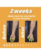 Alkar erősítő gumiszalag