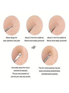 Mitesszer eltávolító készlet