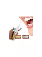 Vezeték nélküli fogászati öblítő - fogápolás, szájhigiénia, fogmosás, fogápoló eszköz, fogápolás otthon