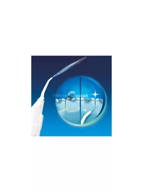 Vezeték nélküli fogászati öblítő - fogápolás, szájhigiénia, fogmosás, fogápoló eszköz, fogápolás otthon