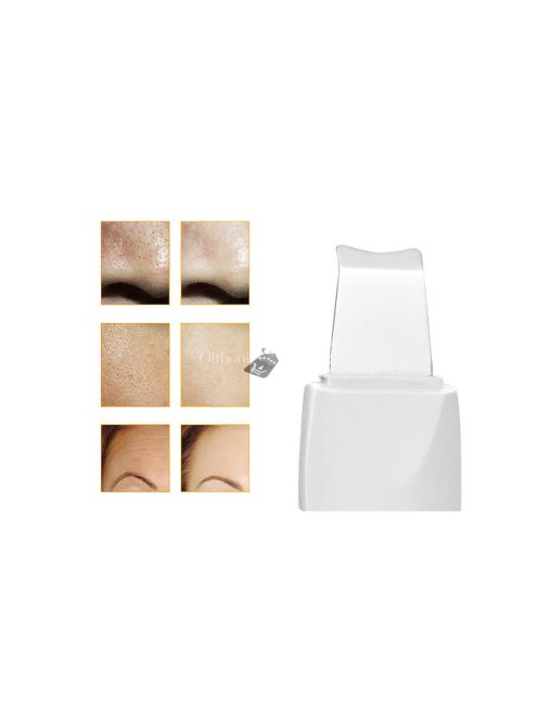 Ultrahangos arctisztító kavitációs peeling akusztikus