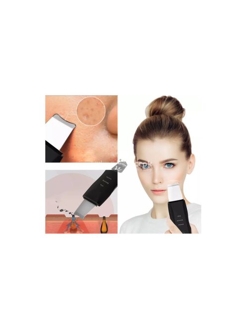 Ultrahangos arc tisztító peeling akkumulátorral