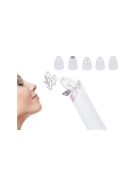 Porszívó bajusz mikrodermabrázió 5 az 1-ben