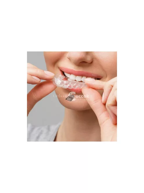 Hegesztett relaxációs sínek 22113