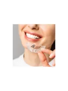 Hegesztett relaxációs sínek 22113