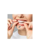 Hegesztett relaxációs sínek 22113