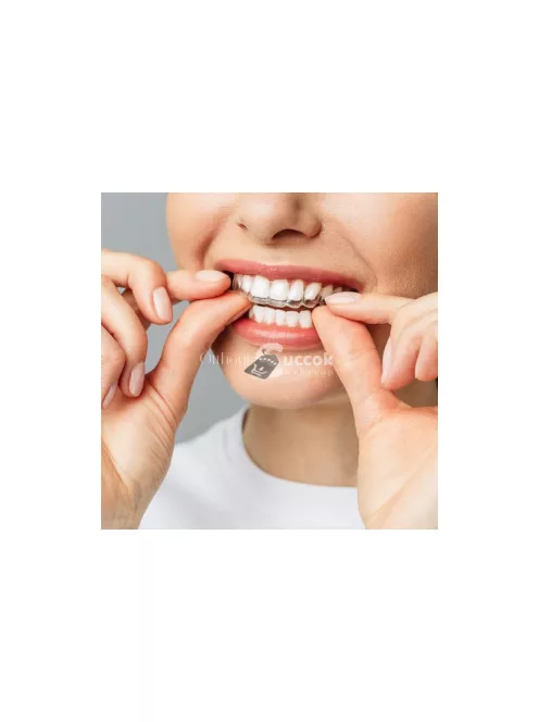 Hegesztett relaxációs sínek 22113